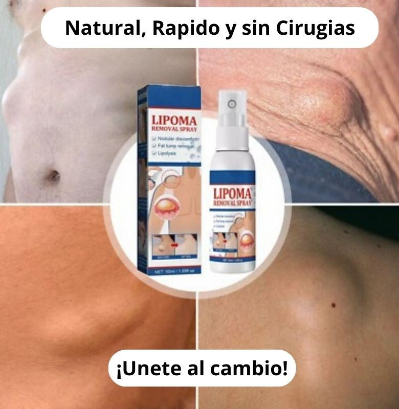 Spray Lipozen🌿 ¡Alivio natural de Lipomas! Pague 1 y lleve el 2 Gratis🌿