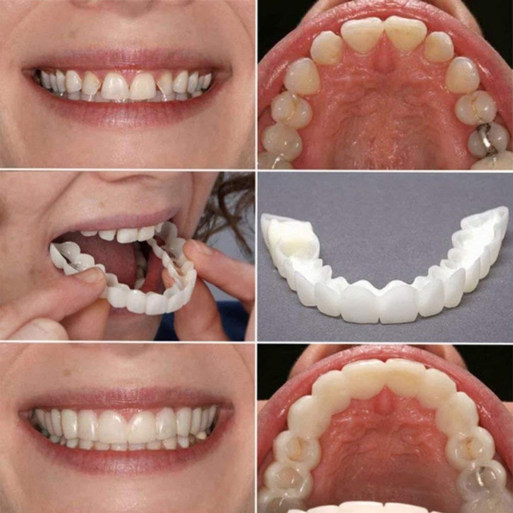 SmileOne™ Carillas dentales ¡Sonríe, come y habla con seguridad, renueva tu sonrisa!