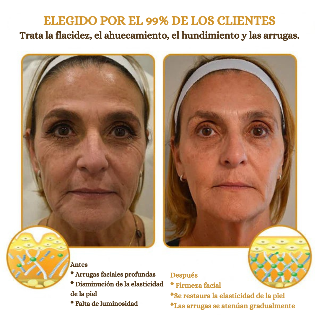 BeeLift🌿¡Crema Efecto Botox anti-edad, Adiós arrugas y parpados caídos! 30Ml