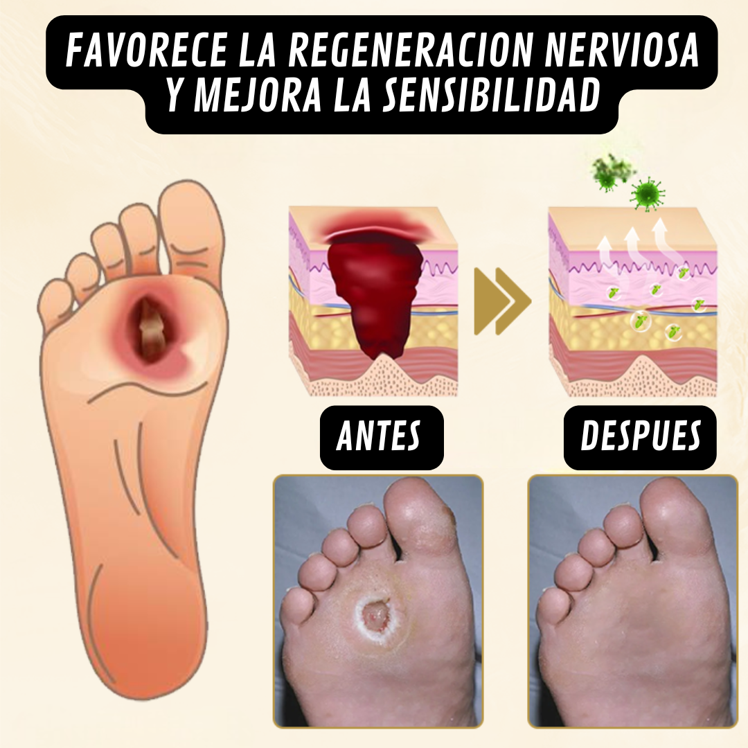 Spray Diabetic🌿¡Alivio natural y cicatrización de pie diabético! Pague 1 y lleve el 2 Gratis!
