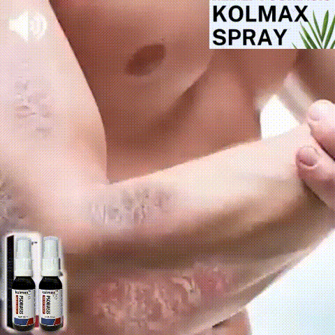 🌿Spray ¡Alivio inmediato de la picazón y descamación! Pague 1 y Lleve el 2 Gratis!