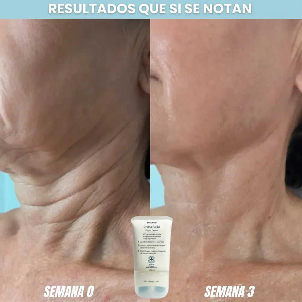 LiftCollagen™🌿 ¡Crema en rodillo, Recupera la firmeza y juventud de tu cuello! Adios papada y lineas del cuello
