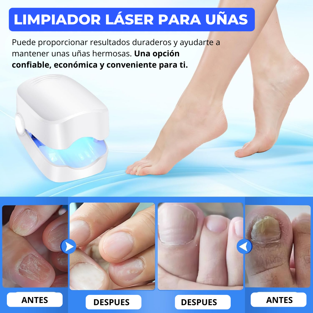 FungiLase🧬¡Dispositivo laser Antihongos, Adiós Onicomicosis!