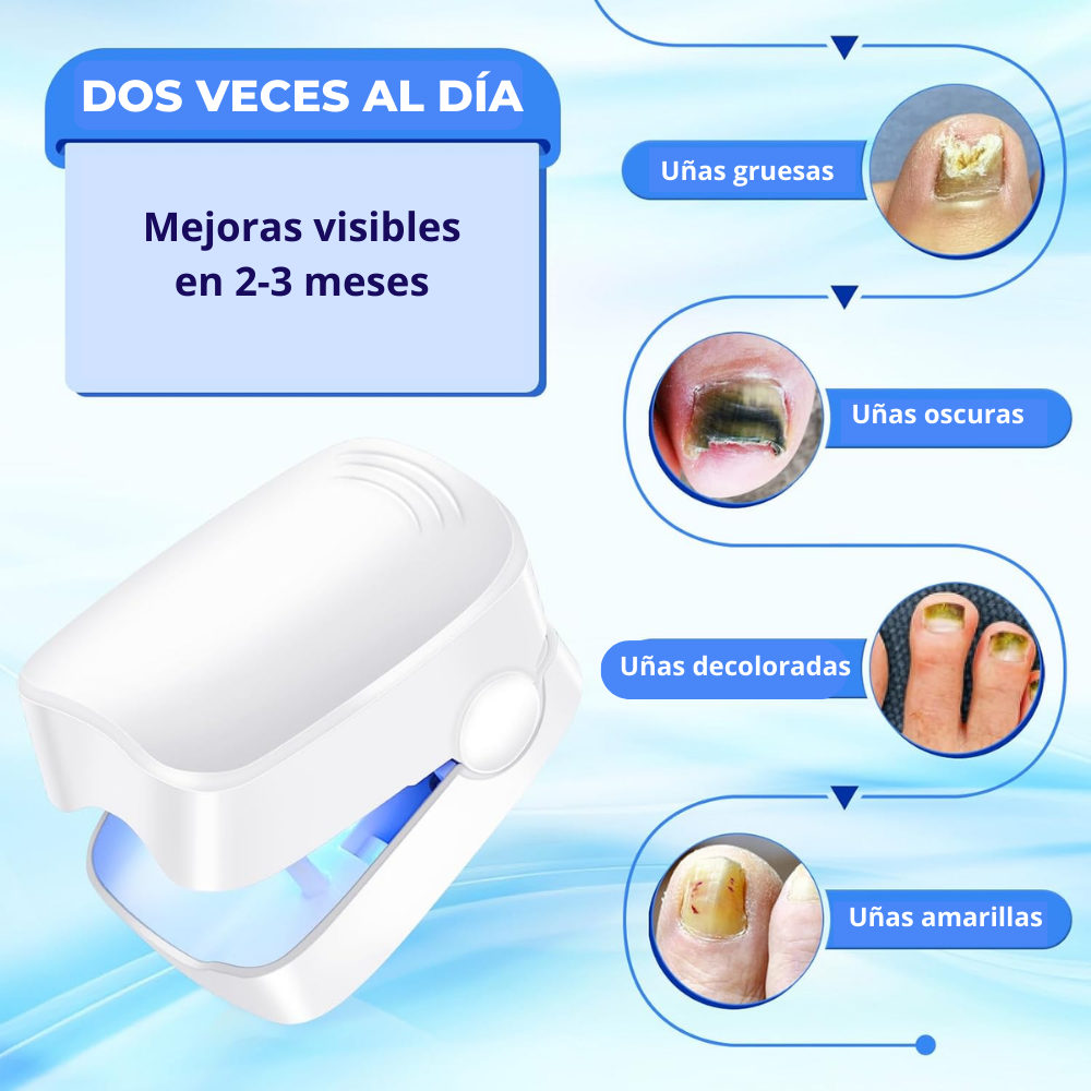 FungiLase🧬¡Dispositivo laser Antihongos, Adiós Onicomicosis!
