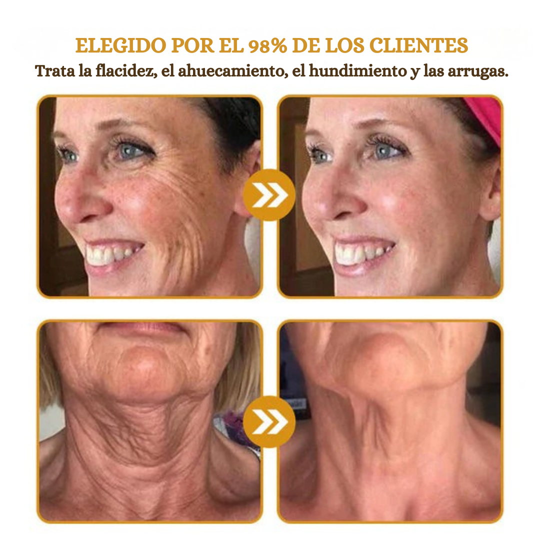 BeeLift🌿¡Crema Efecto Botox anti-edad, Adiós arrugas y parpados caídos! 30Ml