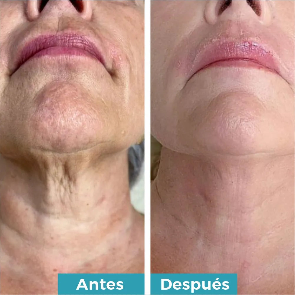 LiftCollagen™🌿 ¡Crema en rodillo, Recupera la firmeza y juventud de tu cuello! Adios papada y lineas del cuello