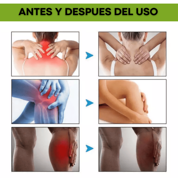 Beevana🌿¡Alivio natural para el dolor articular! Pague 1 y lleve el 2 Gratis