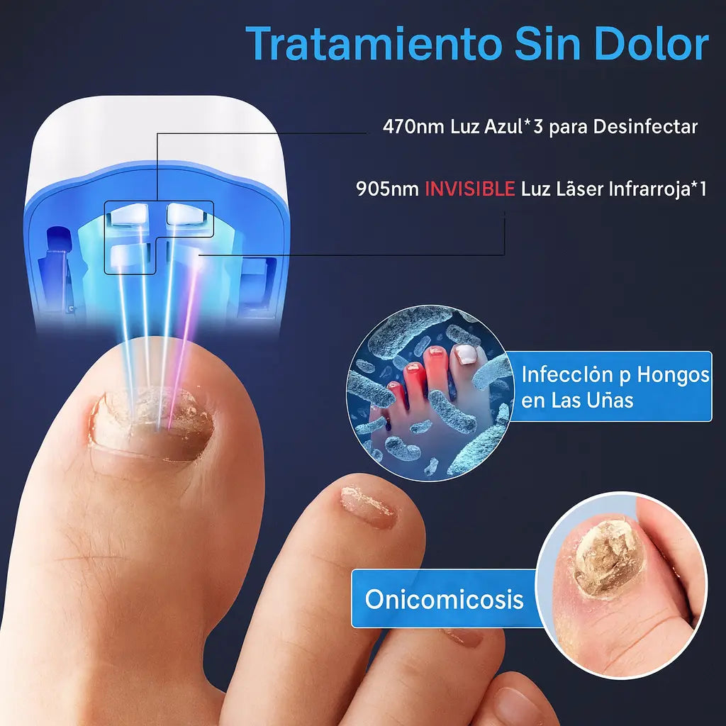 FungiLase🧬¡Dispositivo laser Antihongos, Adiós Onicomicosis!