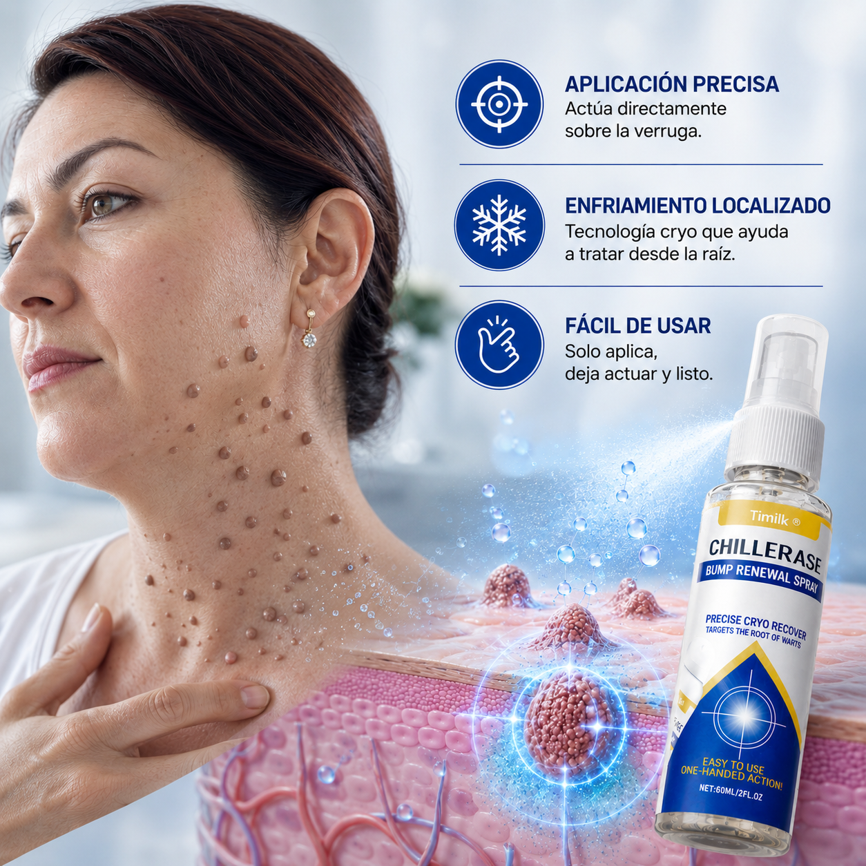 CryoClear🌿¡Despídete de verrugas y lunares, sin dolor y sin cicatriz¡ PROMO 45% OFF SOLO POR HOY!