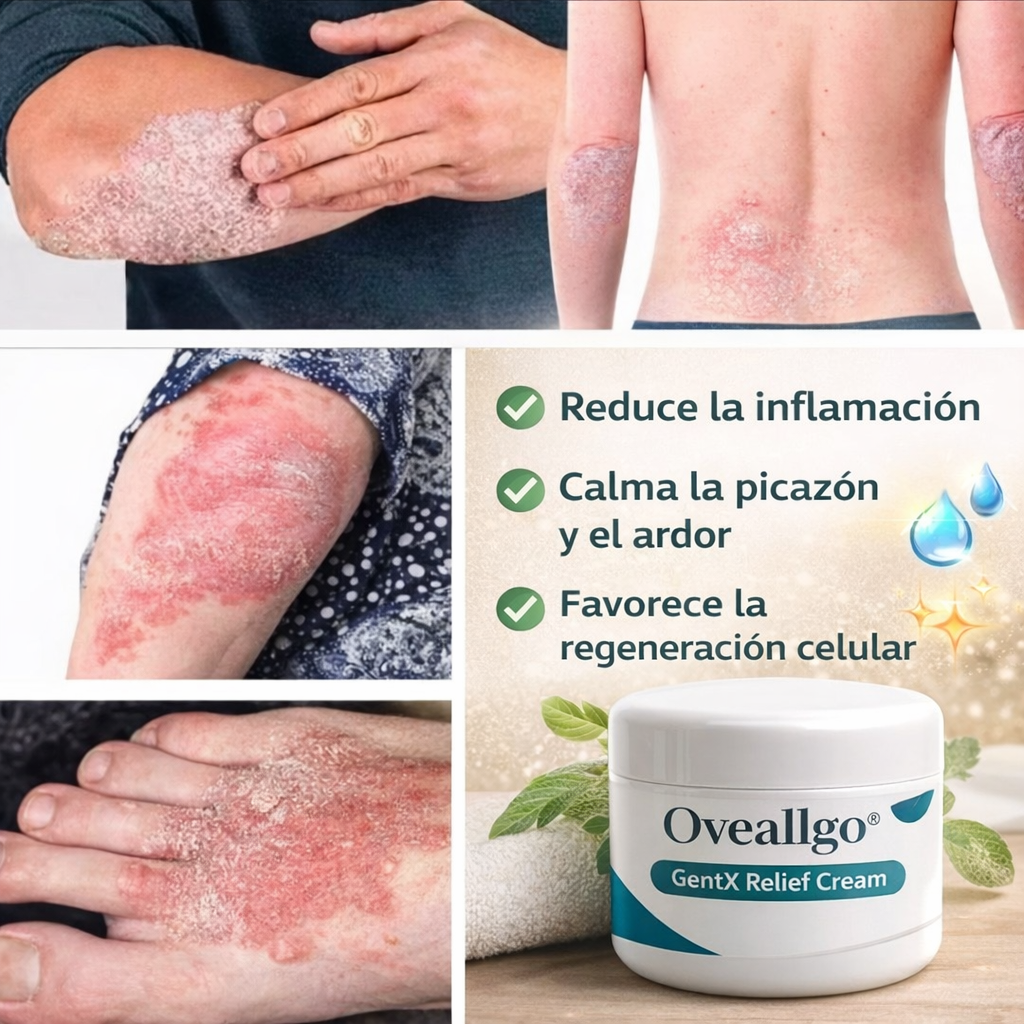 DermaCalm® ¡Alivio real para picazón, ardor, y brotes en la piel! Solo por HOY 40% De descuento