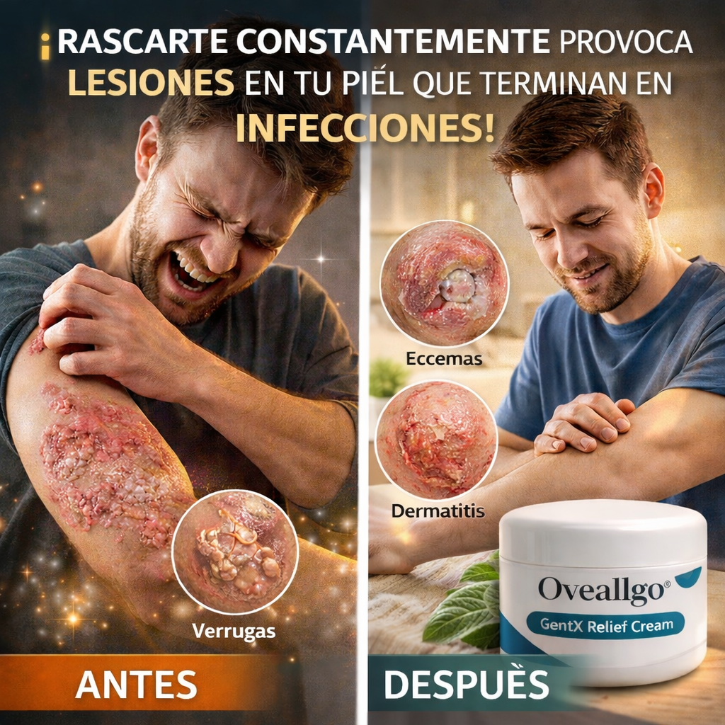 DermaCalm® ¡Alivio real para picazón, ardor, y brotes en la piel! Solo por HOY 40% De descuento