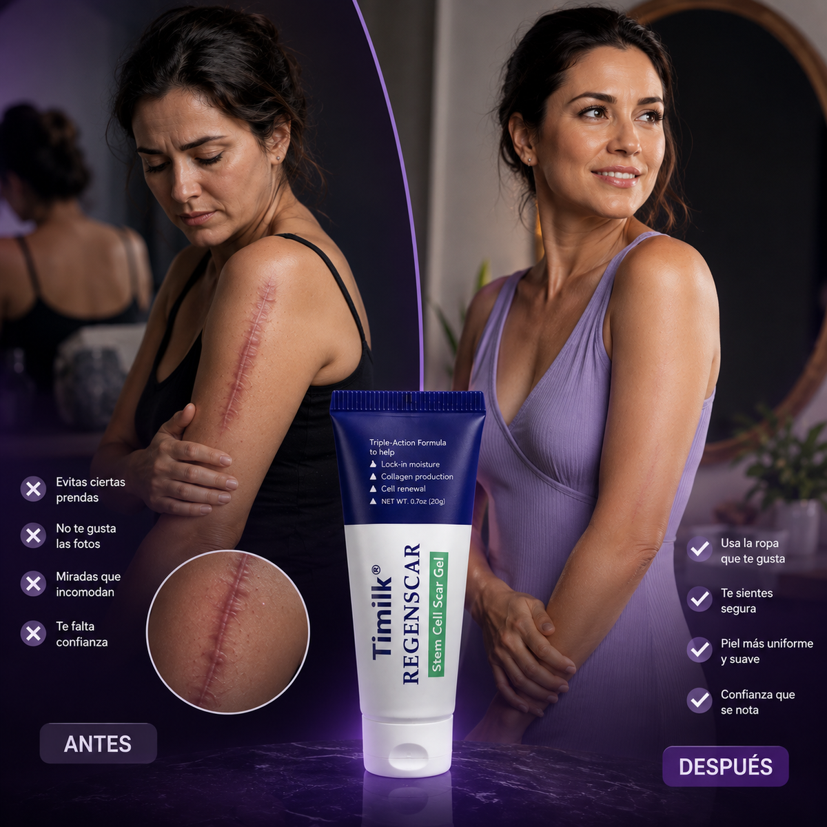 ReGenScar🌿¡Gel reparador de cicatrices, recupera tu seguridad y luce una piel sana y sin imperfecciones! 80 G