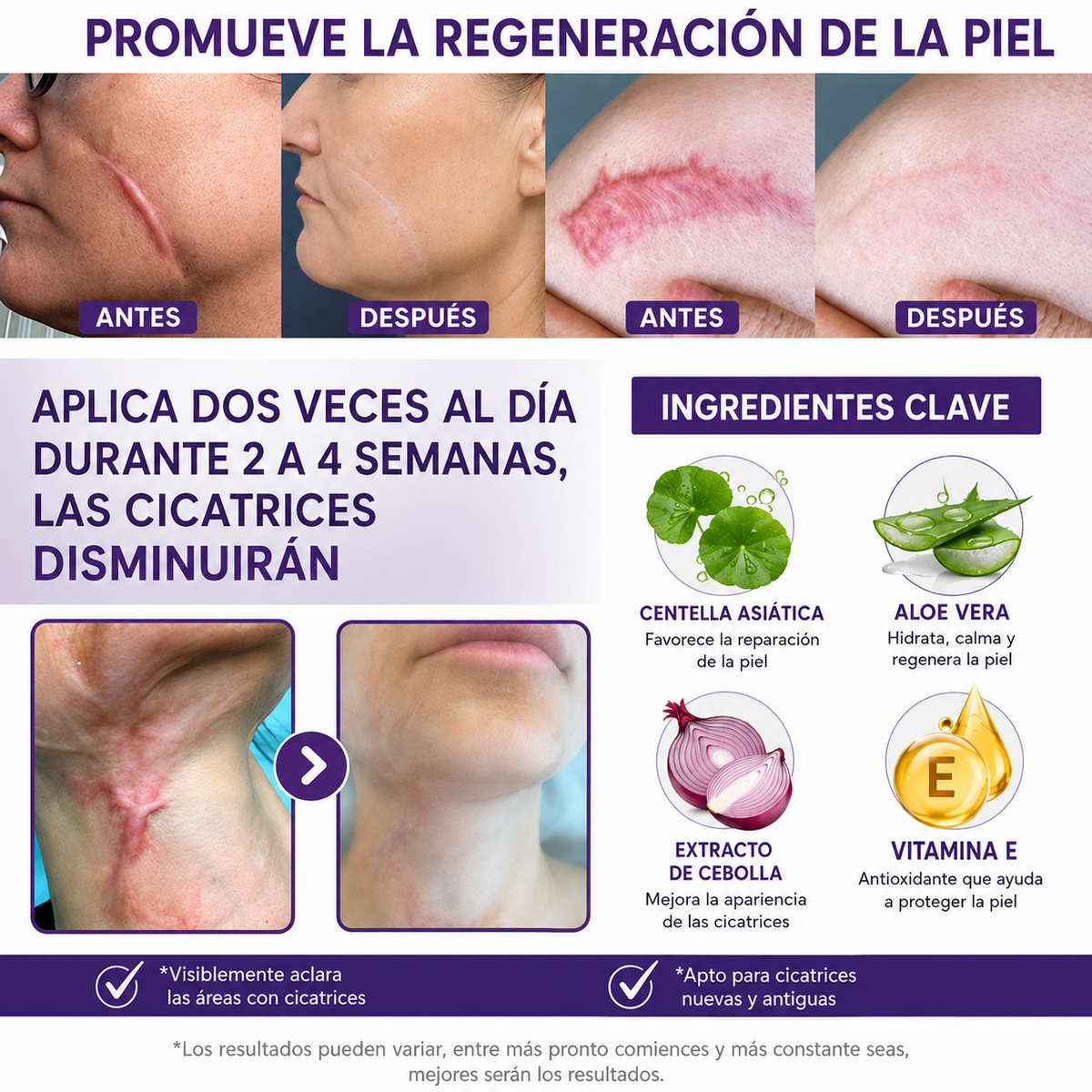 ReGenScar🌿¡Gel reparador de cicatrices, recupera tu seguridad y luce una piel sana y sin imperfecciones! 80 G