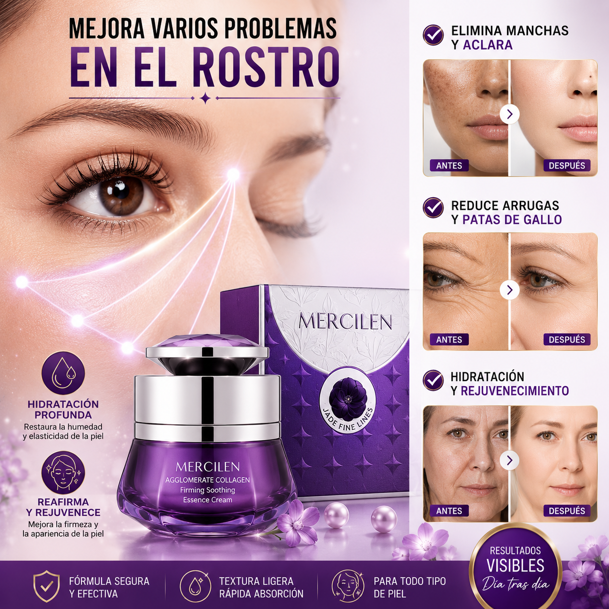 Mercilen® ¡Crema antiarrugas recupera los signos de juventud y despídete de las arrugas!