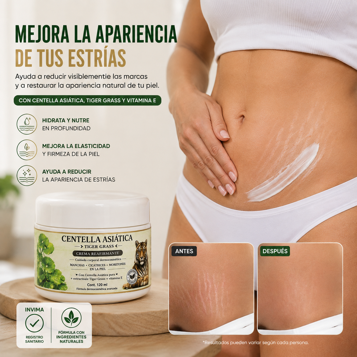CentaSkin🌿¡Crema reparadora para estrías y marcas! Recupera tu seguridad y luce una piel sana y sin imperfecciones! 120ML