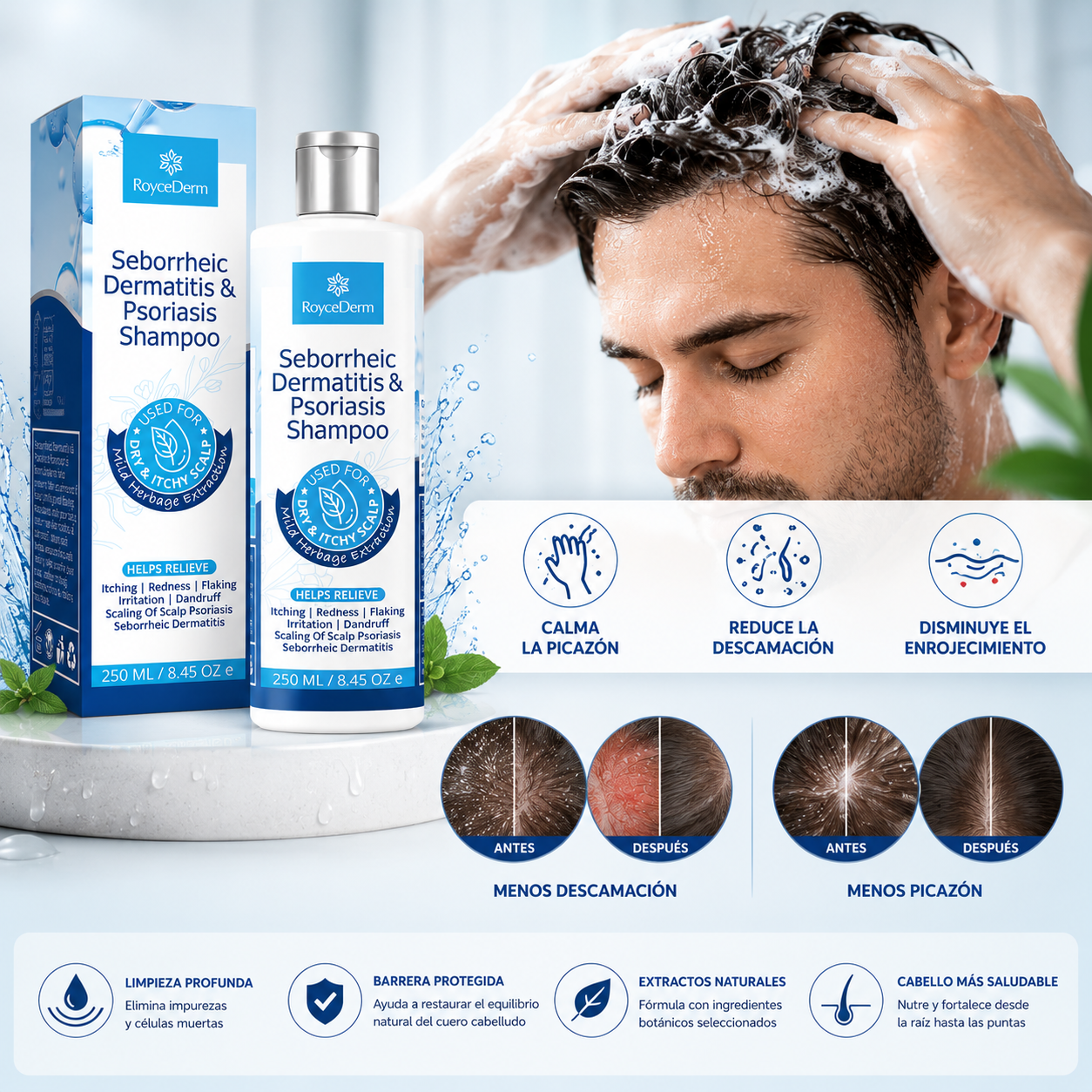 Shampoo DermaZen🌿 ¡Tratamiento Bioregenerativo para la dermatitis, psoriasis y caspa! 250 ML