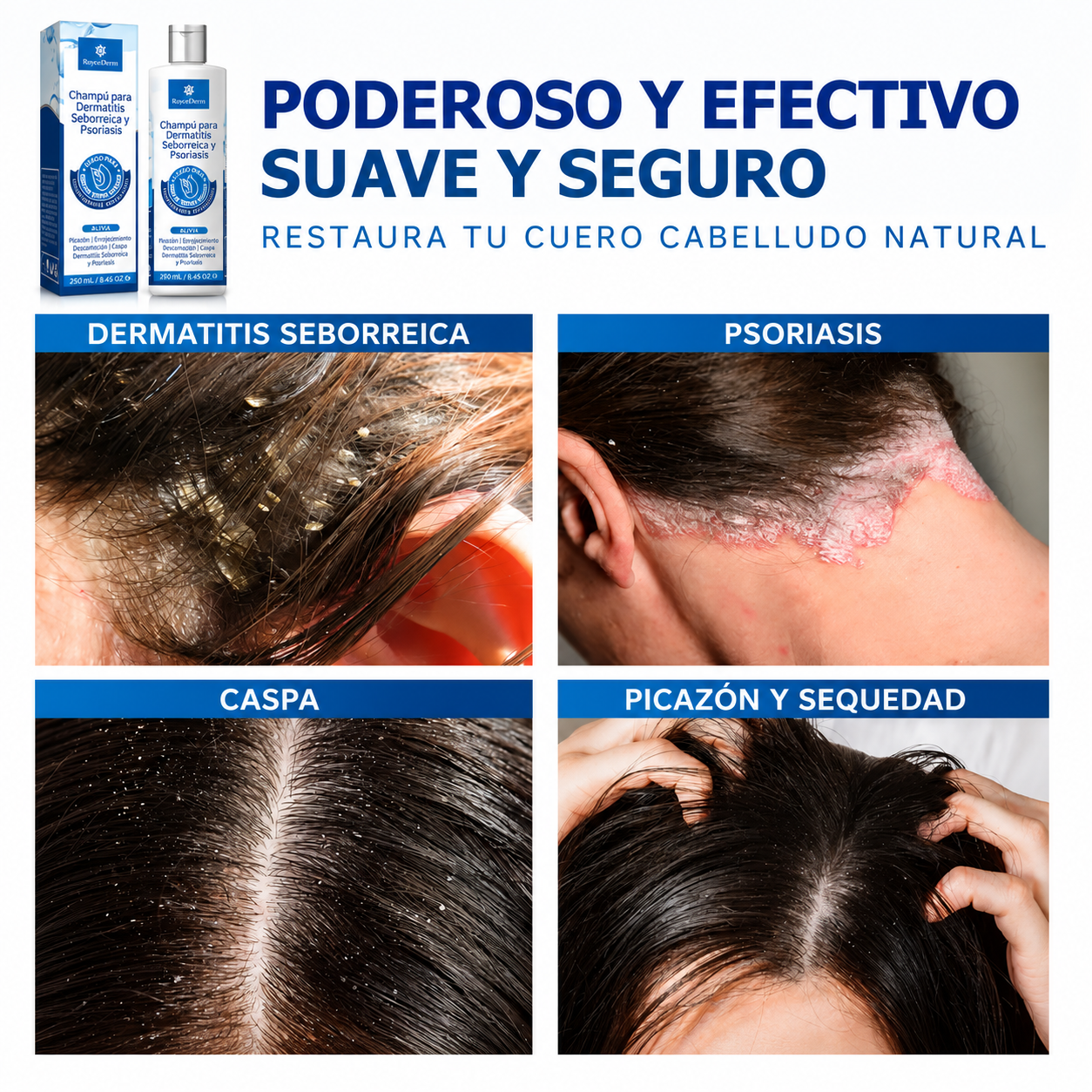Shampoo DermaZen🌿 ¡Tratamiento Bioregenerativo para la dermatitis, psoriasis y caspa! 250 ML