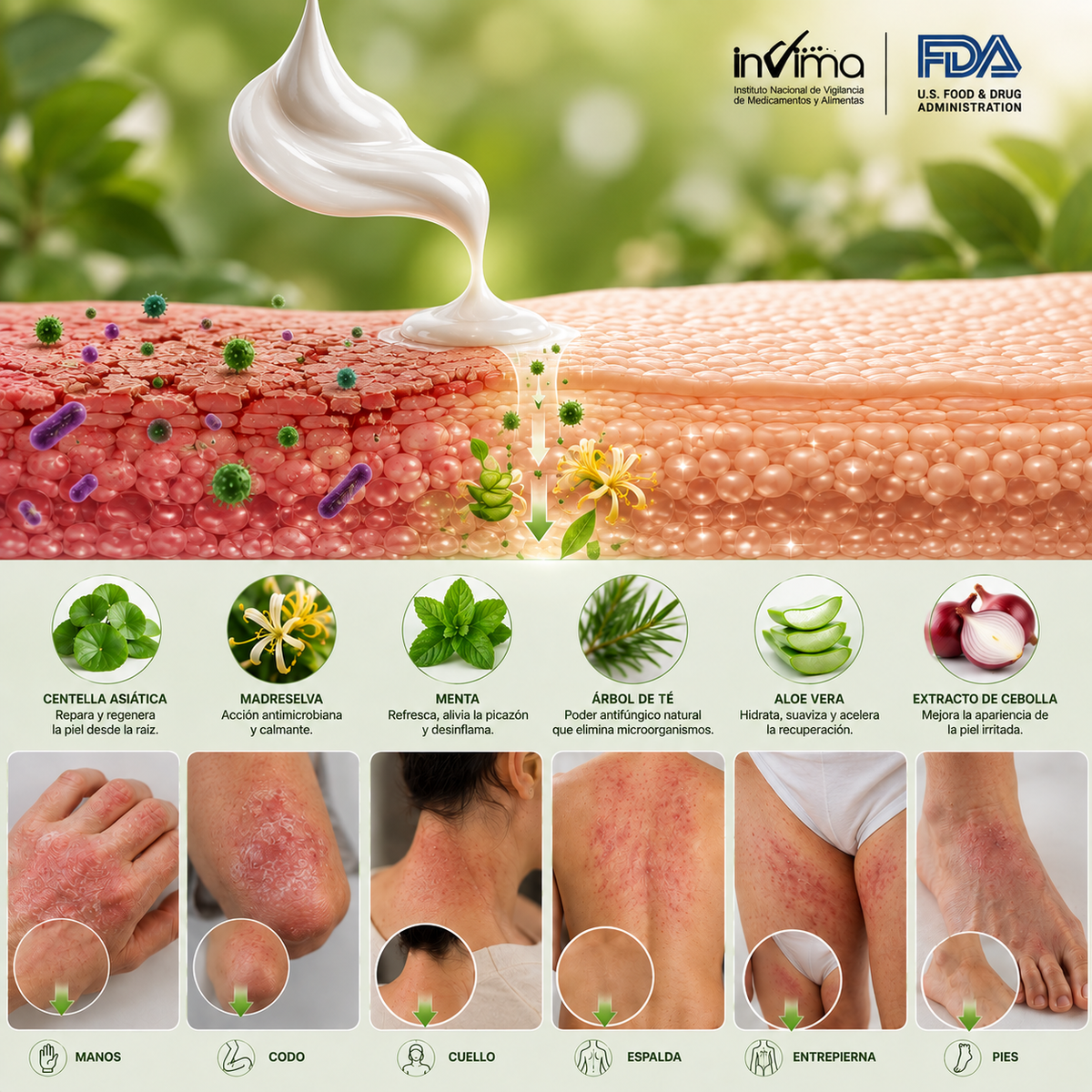 DermaRelief🌿¡Combate los hongos de la piel y Alivia síntomas como picazón, ardor, y brotes en la piel!