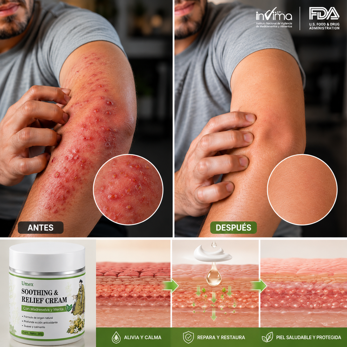DermaRelief🌿¡Combate los hongos de la piel y Alivia síntomas como picazón, ardor, y brotes en la piel!
