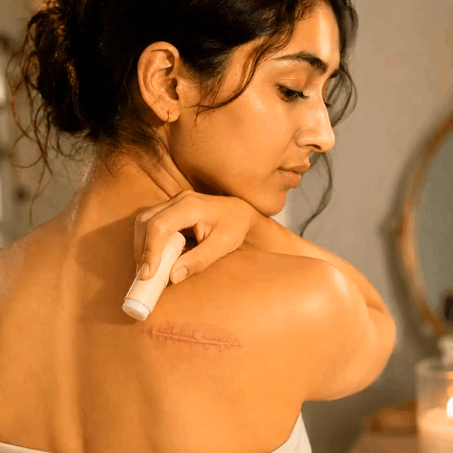 Scariva™ ¡Barra Reparadora de Cicatrices, recupera tu seguridad y luce una piel limpia y sin imperfecciones! Solo HOY 45%OFF