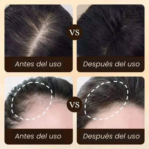 CapilVita🌿¡Activa el crecimiento del cabello y combate la alopecia! Por llevar 1 te damos el 2do Gratis