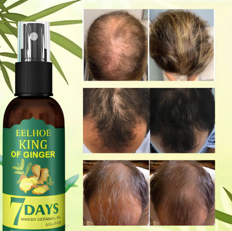 Vitaraiz🌿 ¡Reactiva el crecimiento en 7 días, de forma rápida, natural y efectiva!