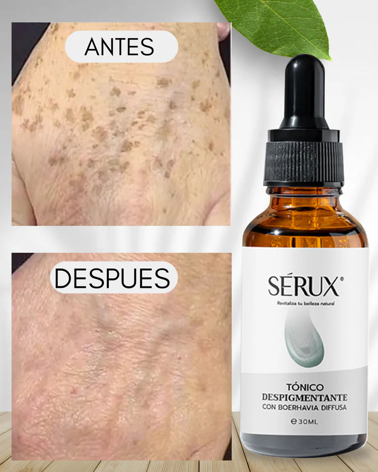 Serux despigmentante🌿Elimina Manchas y Luce un Rostro joven en solo semanas 30ML🌟