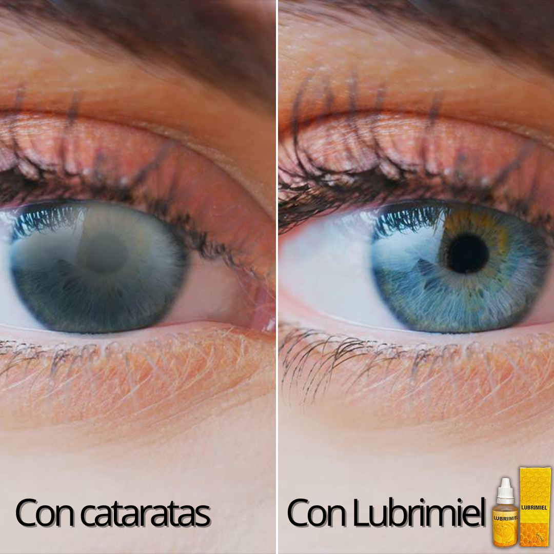Gotas Ocumiel🌿 ¡Alivio ocular con el poder de la miel, hidrata y protege tus ojos!
