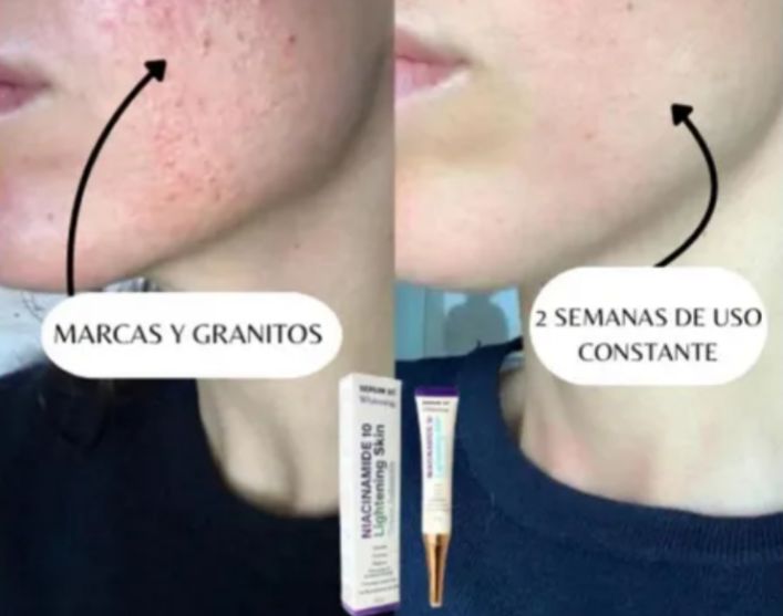 Niaclear 2X1⭐ ¡Transforma tu piel con el poder de la Niacinamida!