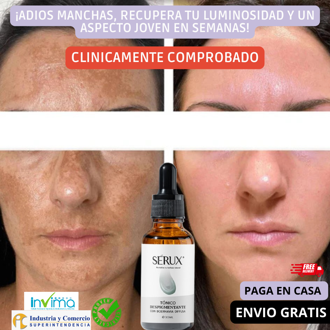 Serux despigmentante🌿Elimina Manchas y Luce un Rostro joven en solo semanas 30ML🌟