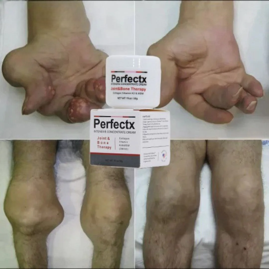 Crema Perfectx🌿 ¡Alivio natural para las articulaciones y músculos! Promo 2X1