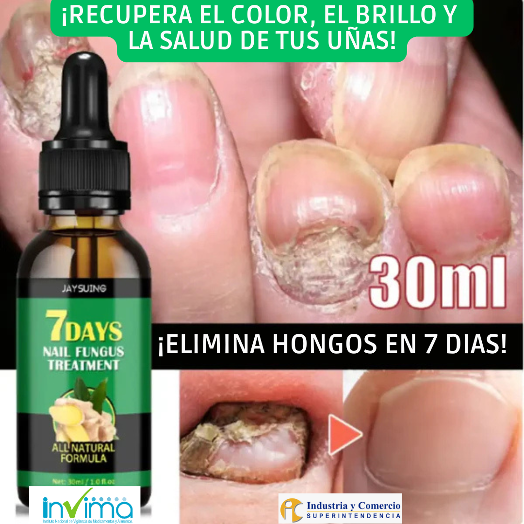 🌿Aceite Natural Antihongos y Fortalecedor de Uñas🌿¡Black Fridayl Pague 1 y lleve el 2 Gratis!