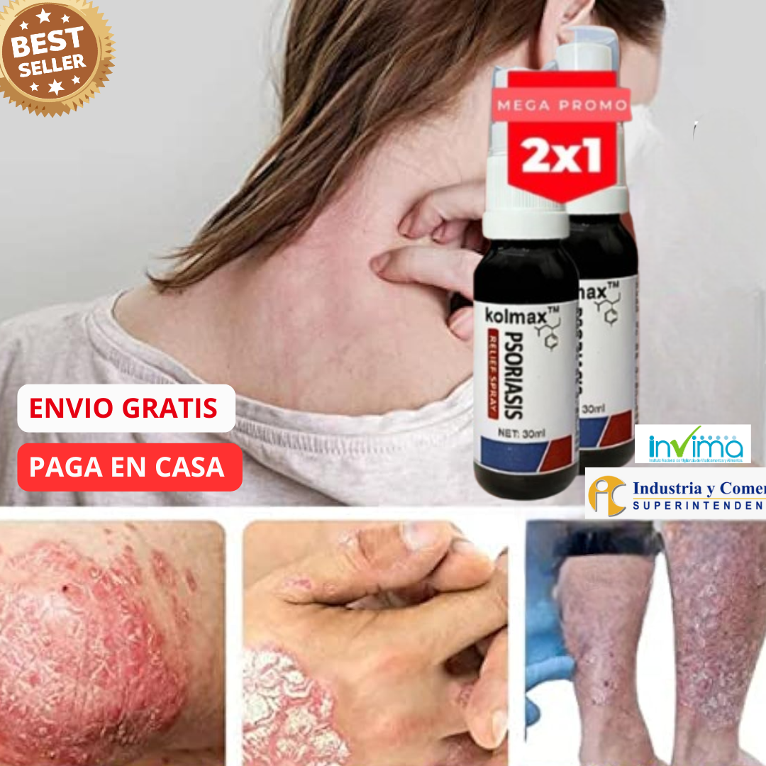 🌿Spray ¡Alivio inmediato de la picazón y descamación! Pague 1 y Lleve el 2 Gratis!