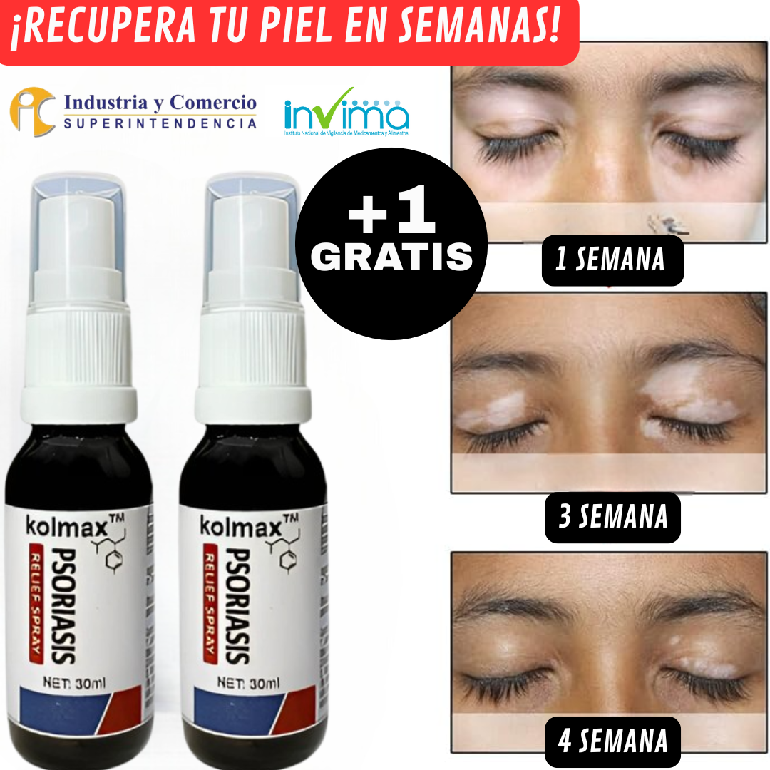 🌿Spray ¡Alivio inmediato de la picazón y descamación! Pague 1 y Lleve el 2 Gratis!