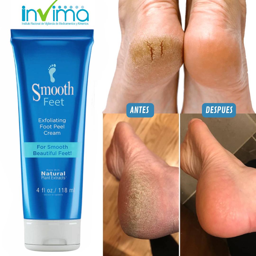 SmoothStep🌿¡Elimina callos, resequedad y grietas en pies! Crema 118 ML Oferta especial