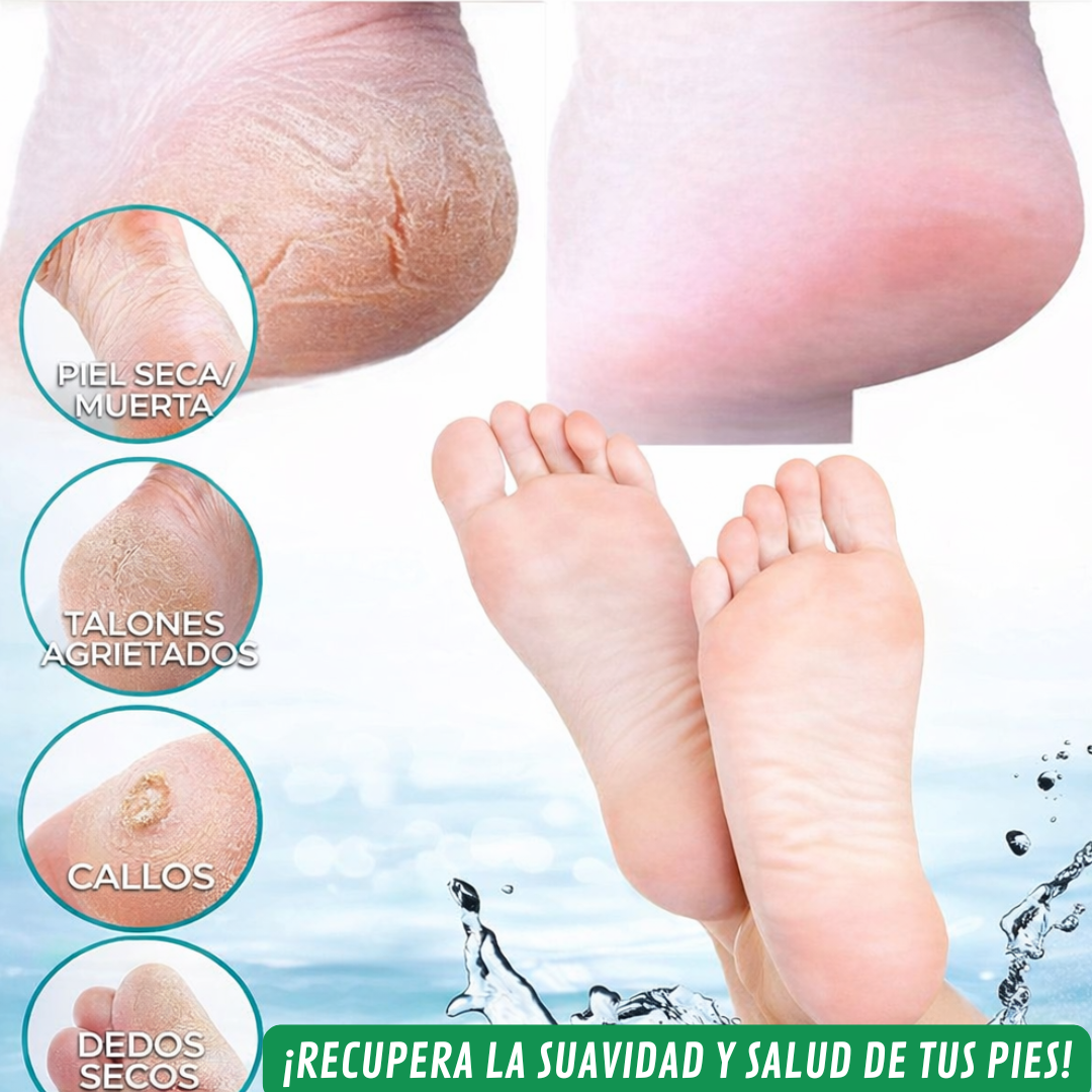 SmoothStep🌿¡Elimina callos, resequedad y grietas en pies! Crema 118 ML Oferta especial