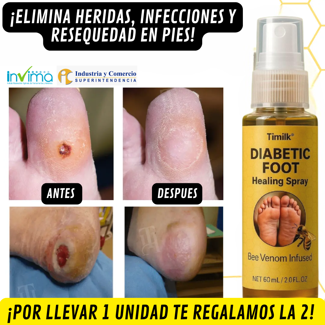 Spray Diabetic🌿¡Alivio natural y cicatrización de pie diabético! Pague 1 y lleve el 2 Gratis!