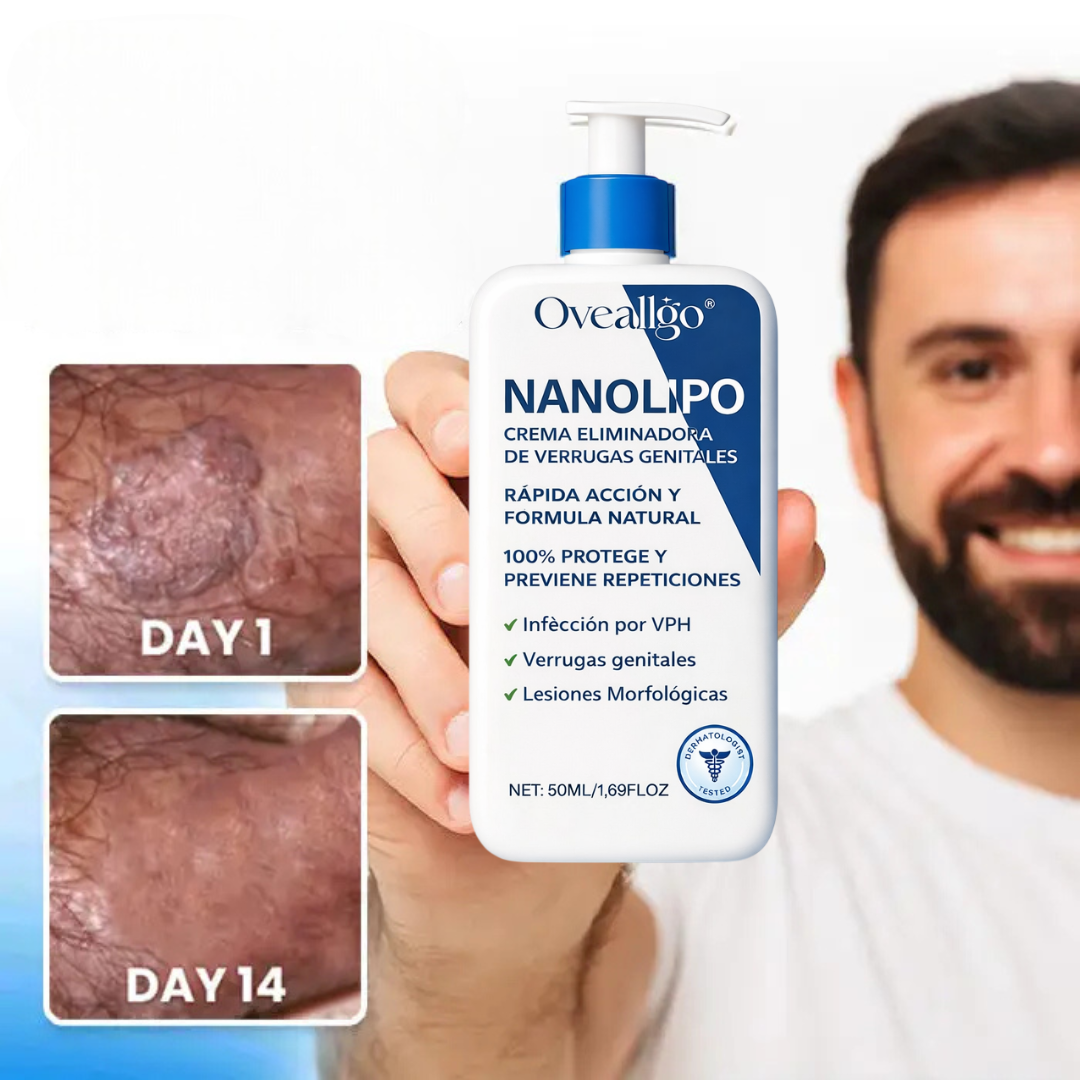 NaNolipo®🌿 ¡Despídete de las verrugas genitales y recupera tu confianza! ¡SOLO HOY 40% Descuento! 50Ml