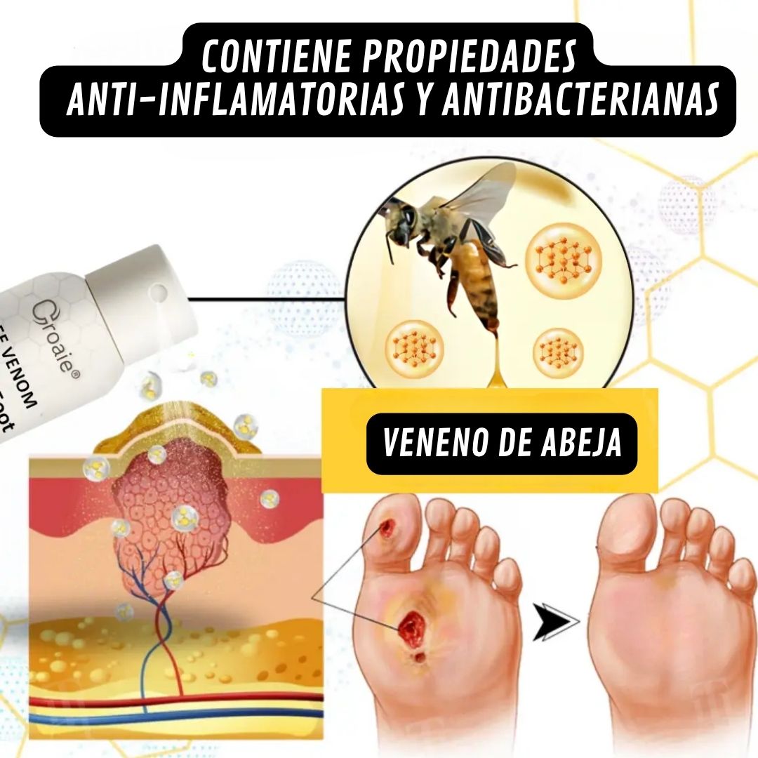 Timilk Diabetic🌿¡Spray curativo para pies diabéticos, Alivio natural y cicatrización de piel diabética!