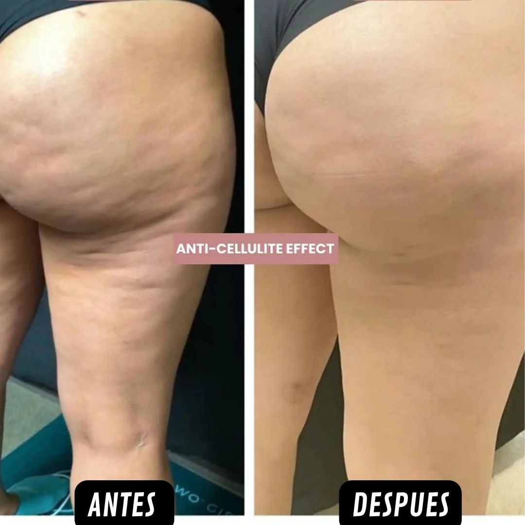 CelluSilk™ ¡Aceite Anticelulitis, Mejora la circulacion y recupera tu confianza! Promo 45% OFF