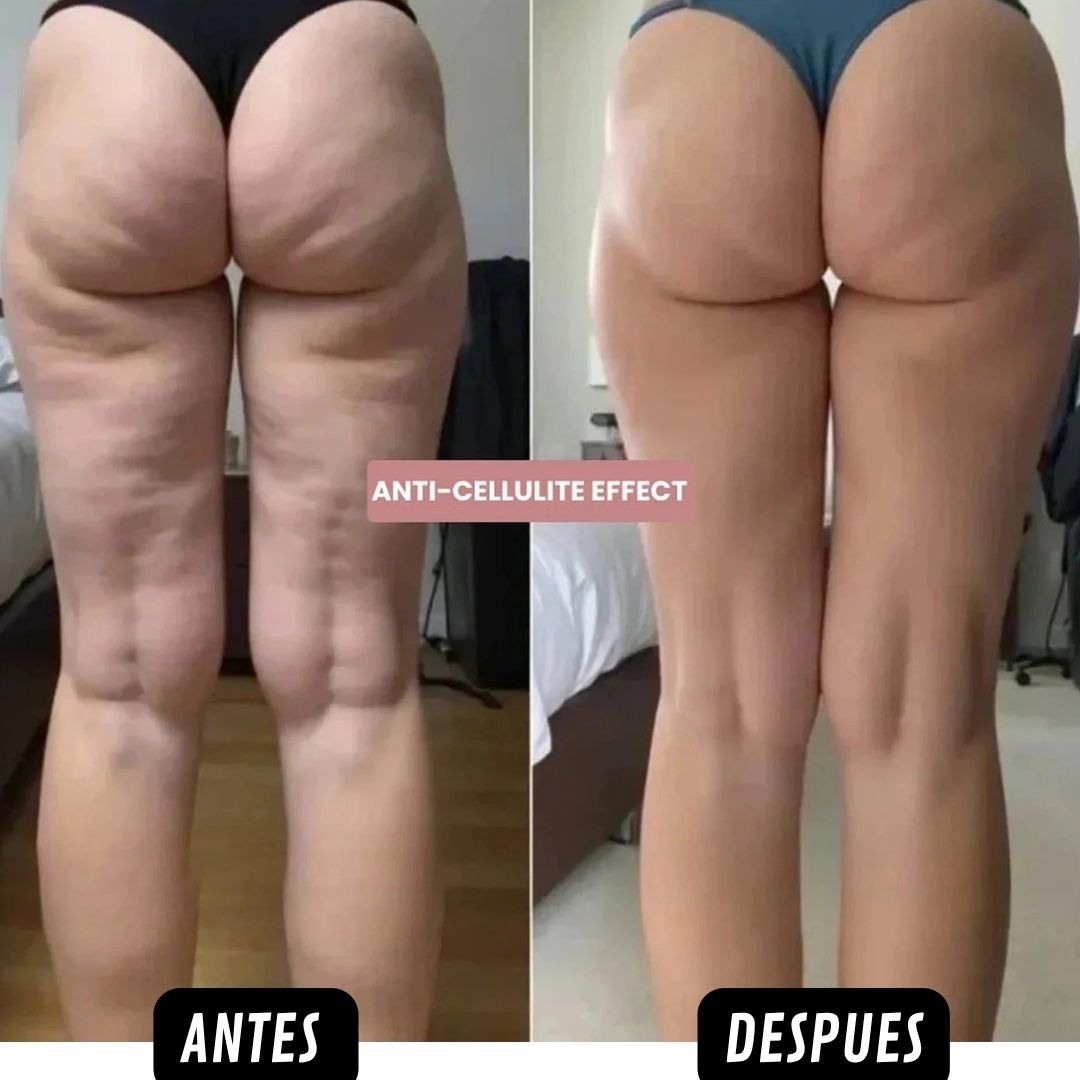 CelluSilk™ ¡Aceite Anticelulitis, Mejora la circulacion y recupera tu confianza! Promo 45% OFF