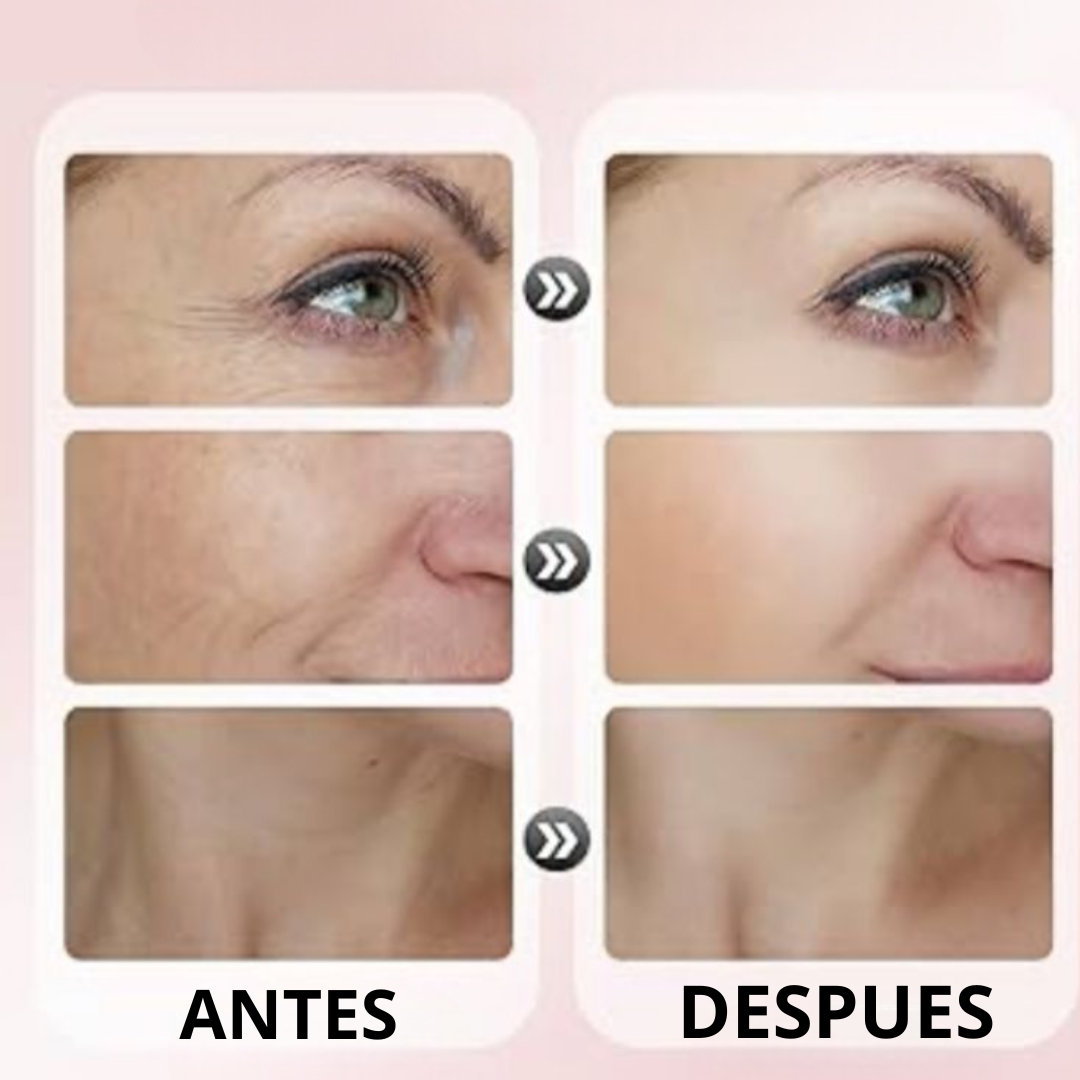 Niaclear 2X1⭐ ¡Transforma tu piel con el poder de la Niacinamida!