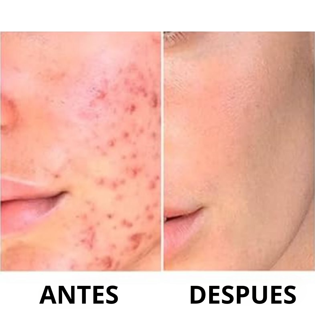 Niaclear 2X1⭐ ¡Transforma tu piel con el poder de la Niacinamida!