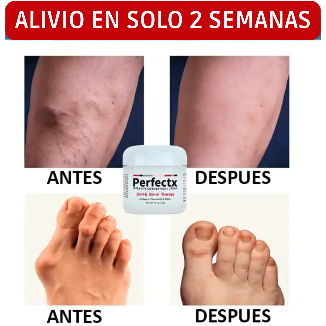 Crema Perfectx🌿 ¡Alivio natural para las articulaciones y músculos! Promo 2X1