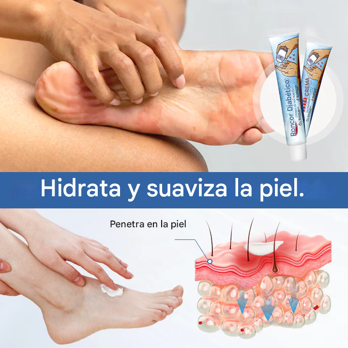 DiabeticFoot🌿¡Crema reparadora para piel en Diabéticos! Promo 45%Off