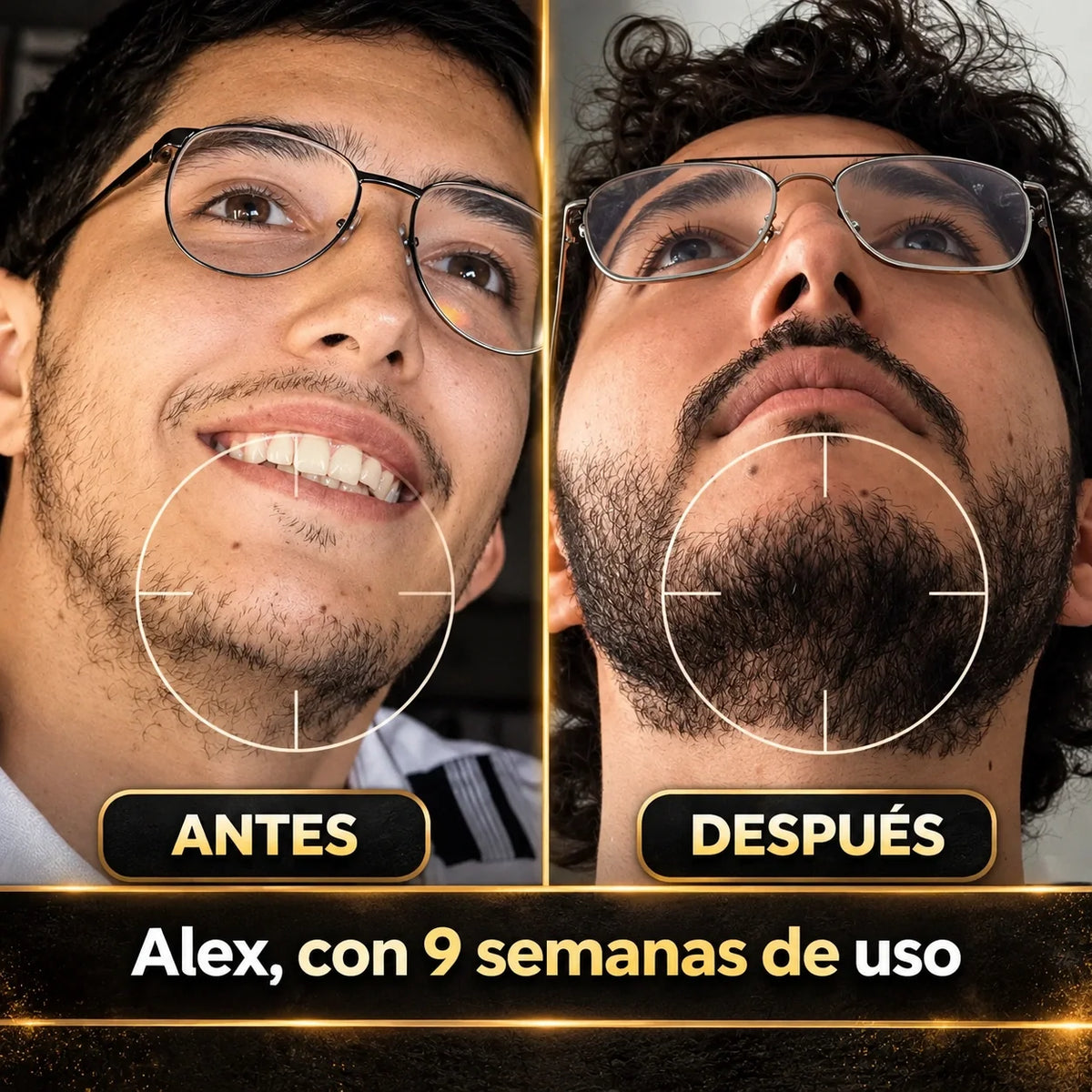 Balsamo Apolo ¡Activa el crecimiento de tu Barba, Luce una apariencia joven, bello y huele delicioso! Promo HOY