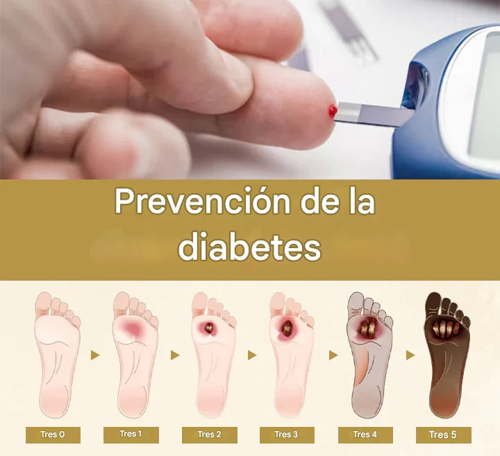 Timilk Diabetic🌿¡Spray curativo para pies diabéticos, Alivio natural y cicatrización de piel diabética!