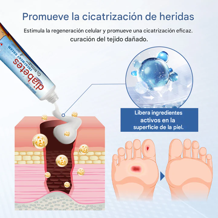 DiabeticFoot🌿¡Crema reparadora para piel en Diabéticos! Promo 45%Off