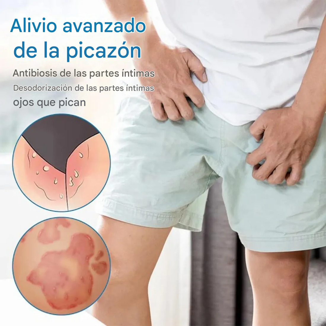 Oveallgo🌿¡Crema para el alivio de verrugas genitales! ¡Promo SOLO POR HOY 45% Descuento! 80G