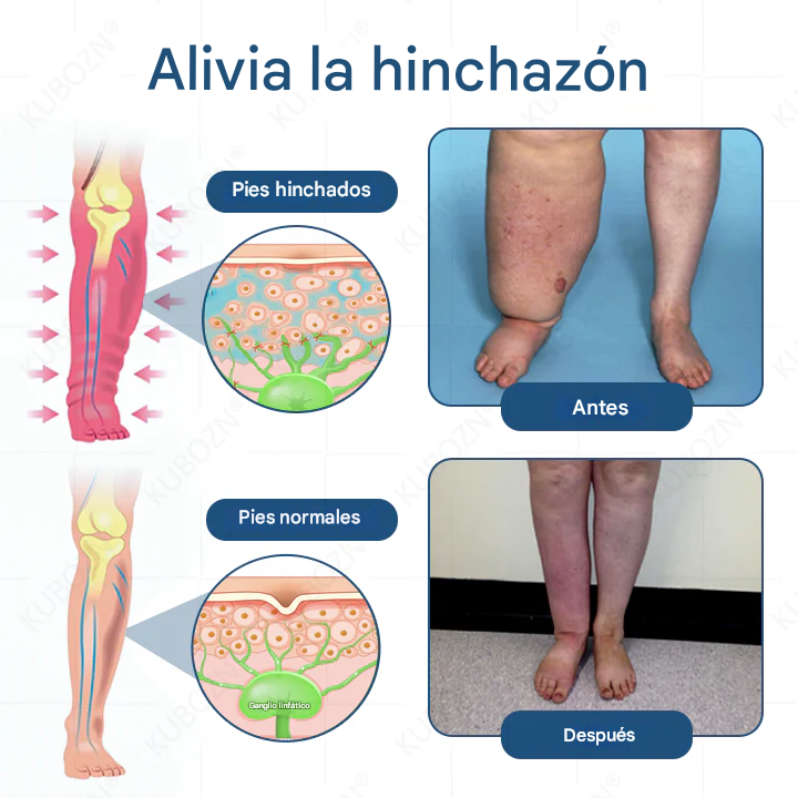 Kubozn🌿¡Crema para drenaje linfático y alivio de la hinchazón! Elimina el dolor y la rigidez Promo 45%Off